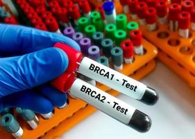 brca1 en brca2 zijn twee genen dat zijn belangrijk naar vechten kanker gebeld tumor suppressor genen. borst kanker. foto