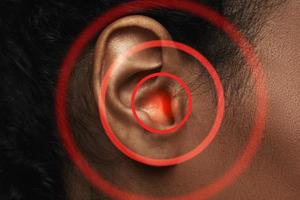 detailopname van zwart vrouw oor met bron van pijn foto