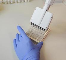 het uitvoeren van laboratorium analyse door enzym immunoassay. een bloed test van een ader. portable pipet voor behandeling vloeistoffen. vloeistof media verwerken systeem. laboratorium diagnostiek foto