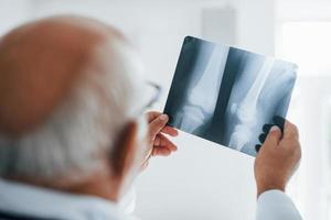 senior Mens dokter in wit uniform onderzoekt röntgenstraal van menselijk poten foto