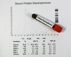 bloed monster en patiënten verslag doen van geïsoleerd voor eiwit elektroforese testen. dichtbij omhoog. foto