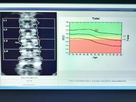 bot densitometer wervelkolom verslag doen van pape foto