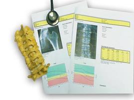 bot dichtheid heup en lumbale wervelkolom resultaat osteoporose foto