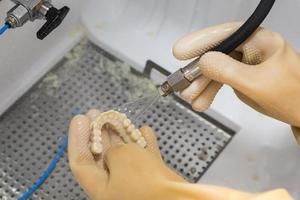tandheelkundig technicus reinigt 3d gedrukt tandheelkundig implantaat brug foto