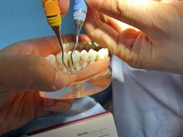tanden model. tandheelkundig studie model- Aan tandarts hand. speelgoed- kaak in kabinet van tandheelkundig kliniek. foto