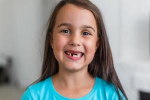 weinig meisje eerste tand missend Aan een wit achtergrond foto