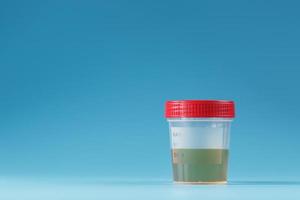 urine in een test houder met een rood deksel Aan een blauw achtergrond. gezondheidszorg en medisch concept. foto