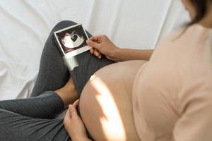 een zwanger vrouw is op zoek Bij een echografie foto van foetus. moeder voorzichtig accenten de baby Aan buik.vrouwen zijn zwanger voor 2-3 dagen of gedurende de eerste trimester.