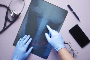 dokter hold analyseren xray fotografie, close-up foto