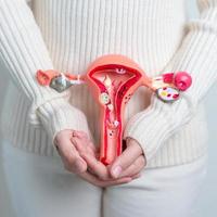 vrouw Holding baarmoeder en eierstokken model. eierstok en cervicaal kanker, baarmoederhals wanorde, endometriose, hysterectomie, baarmoeder vleesbomen, voortplantings- systeem en zwangerschap concept foto
