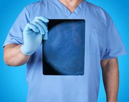 dokter in blauw uniform en latex handschoenen Holding een röntgenstraal van een patiënten borst klier foto