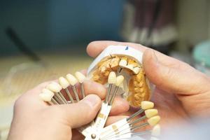 een palet voor het bepalen van de kleur van tanden in de handen van een tandheelkundig orthopeed. foto