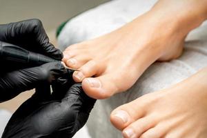 pedicure verwijdert nagelriem van tenen foto