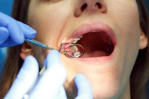 vrouw krijgen een tandheelkundig behandeling foto