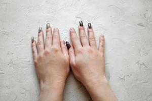 vrouw handen detailopname met opnieuw gegroeid gebroken nagels. gebrek van manicure Aan de handen, verzorgd vrouw handen foto