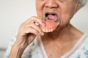 Aziatisch ouderen vrouw geduldig Holding naar gebruik kunstgebit, gezond sterk medisch concept. foto