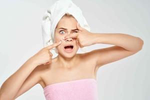 vrouw met een handdoek Aan haar hoofd knijpt uit puistjes Aan haar gezicht schoon huid Gezondheid foto