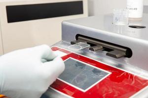 wetenschapper voorbereidingen treffen microscoop dia's met vloeistof gebaseerd cytologie methode voor pap smeren testen. cervicaal kanker concept. medisch concept. foto