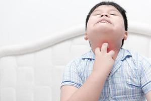 Aziatisch zwaarlijvig jongen krassen de jeuk met hand- Aan bed foto