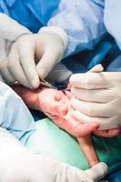 chirurg hechten de hand- van een geduldig Bij de einde van chirurgie foto