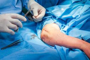 chirurg hechten de arm van een geduldig Bij de einde van chirurgie foto