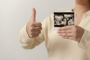 zwanger vrouw Holding echografie film van haar baby. gelukkig moeder en pasgeboren baby in werkwijze. liefde van ouders naar zuigeling in weinig maanden voordat geven geboorte. foto