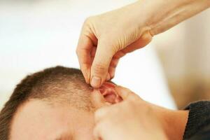 een afbeelding van een Mens hebben acupunctuur Aan oor foto