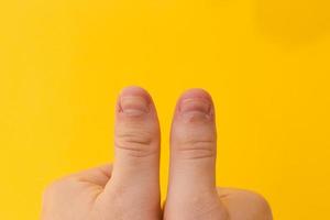 vingers met gebeten nagels geïsoleerd op een gele achtergrond foto
