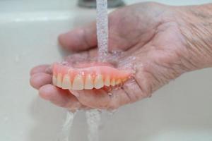 Aziatische senior of oudere oude vrouw patiënt met gedeeltelijk kunstgebit van vervangende tanden
