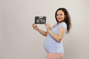 gelukkig aantrekkelijk vrouw, verwachtend zwanger gravid moeder glimlachen en tonen Bij camera haar toekomst baby echografie scannen foto