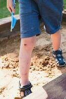 een kind in een zandbak met een gebroken knie - wond, kneuzingen en schaafwonden net zo een resultaat van spelen foto