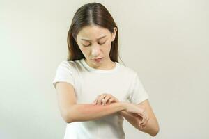 dermatologie Aziatisch jong vrouw, meisje allergie, allergisch reactie van atopisch, insect bijt Aan haar arm, hand- in krabben jeukend, jeuk rood plek of uitslag van huid. gezondheidszorg, behandeling van schoonheid. foto