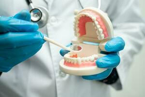 kunstgebit, tandarts Holding tandheelkundig tanden model- naar studie en traktatie in ziekenhuis. foto