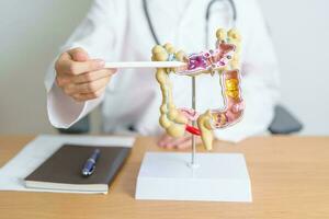 dokter met menselijk dikke darm anatomie model. colon ziekte, groot darm, colorectaal kanker, ulceratief colitis, diverticulitis, prikkelbaar darm syndroom, spijsvertering systeem en Gezondheid concept foto