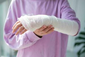 detailopname van een gebroken arm van een kind in een vorm. de meisje houdt haar hand- gevouwen tegen . een kind met een gips Aan zijn hand- foto