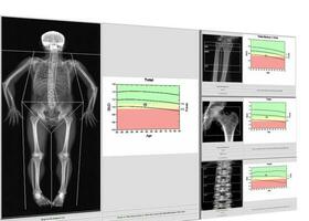 speciaal examen medisch beeld bot dikte. foto