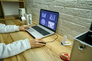detailopname van de handen van een dokter tandarts radioloog analyseren panoramisch tandheelkundig röntgenstraal Aan laptop scherm toezicht houden op in tandartsen kantoor foto