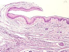 histologie menselijk zakdoek met microscoop van laboratorium foto