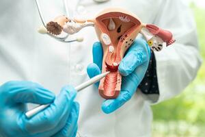 baarmoeder, dokter Holding anatomie model- voor studie diagnose en behandeling in ziekenhuis. foto