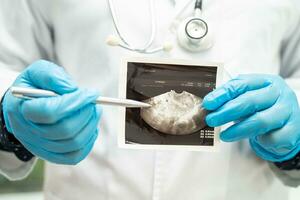 baarmoeder en eierstok, dokter Holding anatomie model- en echografie afbeelding voor studie diagnose en behandeling in ziekenhuis. foto