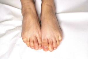 vrouw voet flexie op lakens kleur wit foto