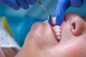 close-up van vrouwelijke patiënt die haar tanden laat onderzoeken door tandartsspecialist. foto