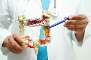 darm, dokter Holding anatomie model- voor studie diagnose en behandeling in ziekenhuis. foto