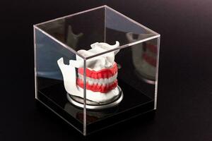 menselijk kaak met tanden implantaten anatomie model- geïsoleerd Aan zwart achtergrond in een glas doos. foto
