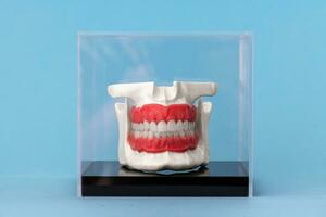 menselijk kaak met tanden implantaten anatomie model- geïsoleerd Aan blauw achtergrond in een glas doos. foto