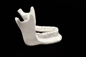bovenste menselijk kaak zonder tanden model- medisch implantaat geïsoleerd Aan zwart achtergrond. gezond tanden, tandheelkundig zorg en orthodontisch concept. foto