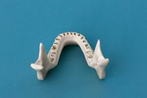 bovenste menselijk kaak zonder tanden model- medisch implantaat geïsoleerd Aan blauw achtergrond. gezond tanden, tandheelkundig zorg en orthodontisch concept. foto