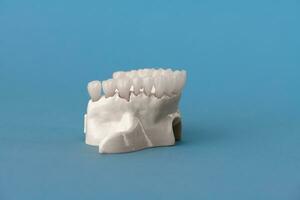 bovenste menselijk kaak met tanden anatomie model- geïsoleerd Aan blauw achtergrond. gezond tanden, tandheelkundig zorg en orthodontisch medisch concept. foto