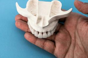 bovenste menselijk kaak met tanden anatomie model- geïsoleerd Aan blauw achtergrond. gezond tanden, tandheelkundig zorg en orthodontisch medisch concept. foto