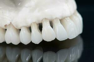 bovenste menselijk kaak met een reflectie Aan de glas anatomie model- geïsoleerd Aan blauw achtergrond. gezond tanden, tandheelkundig zorg en orthodontisch medisch concept. foto